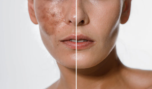 Why Our RPH Technology™ is Changing the Face of Brightening Serum Results